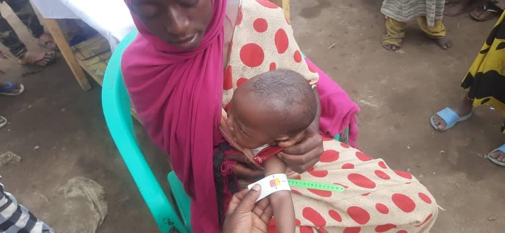 MUAC screening and nutrition care for children in Baarey Village