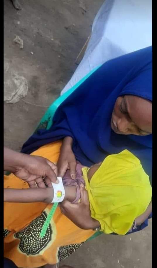 A NASDO healthcare worker conducting MUAC screening for a child