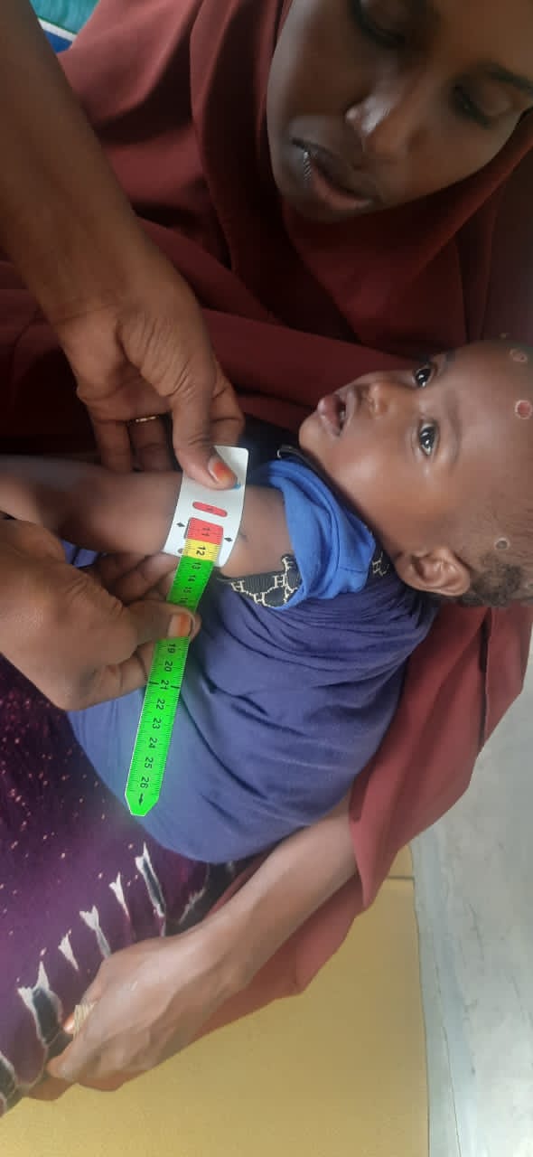 Outpatient therapeutic care at Neero MCH in Abdiaziz District